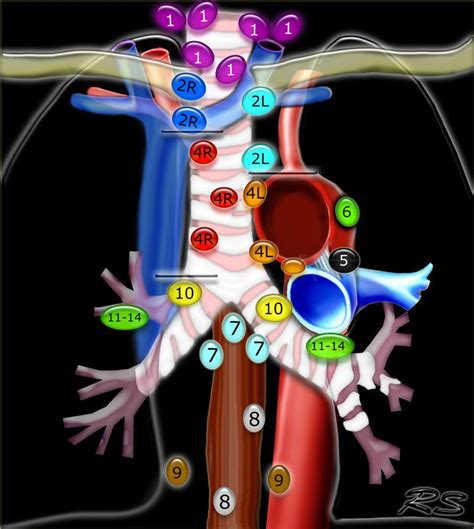 Radiology, Lymph nodes, Radiology imaging