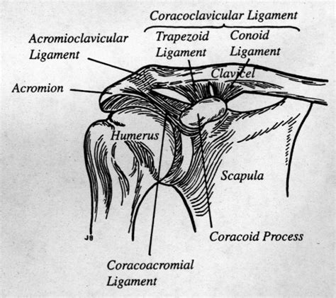 Learning Radiology - Acromioclavicular Separation