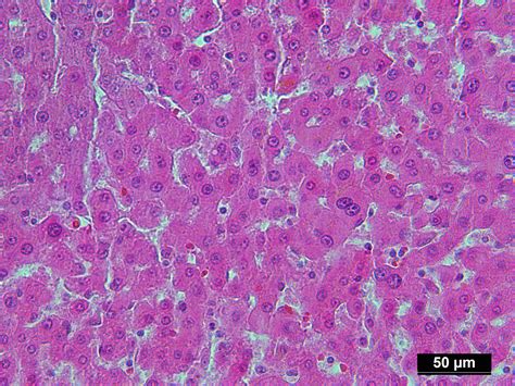 Human Liver Tissue (Normal) FFPE Sections