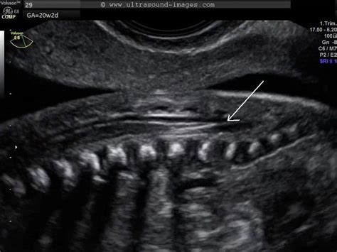 A Gallery of High-Resolution, Ultrasound, Color Doppler & 3D Images ...