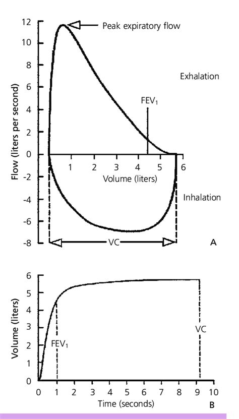 Normal spirometric flow diagram. (A) Flow-volume curve. (B) Volume-time... | Download Scientific ...