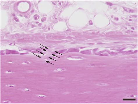 Perforating fibre observed under conventional plain light microscopy.:... | Download Scientific ...