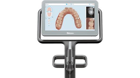 iTero Element 5D Review | Digital Dentistry Blog | Online Training