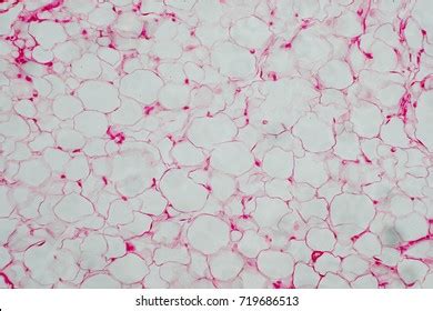 Humanbody Fat Cells Under Microscope View Stock Photo 719686513 ...