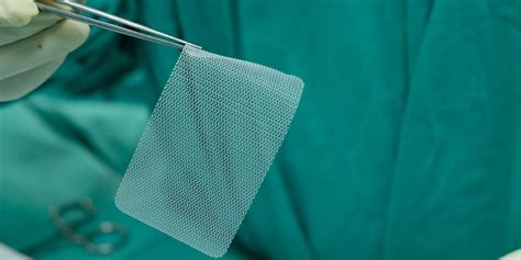 What is Hernia Mesh Made of? - Universal Sutures