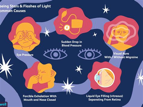 What Causes Flashing Lights In Eyes At Night | Homeminimalisite.com