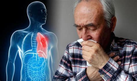 Lung cancer symptoms: Coughing blood could be sign of the deadly ...