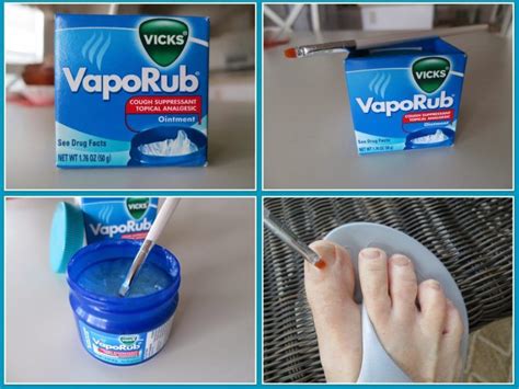 Tried And True Home Remedies For Nail Fungus in 2020 | Nail fungus cure, Vicks vaporub, Toenail ...