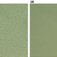 Negative and positive Quellung reaction. Preparations of serotype 9V ...