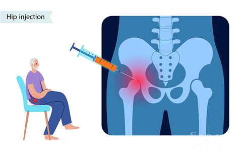 Hip Joint Injection Photograph by Pikovit / Science Photo Library ...