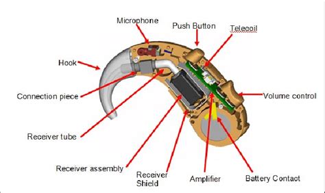 Hearing Aid Diagram