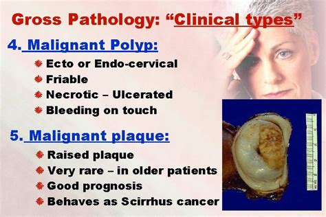 Invasive Cervical Cancer Prof Dr Tawfik Abdel Salam