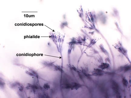 BIOL 230 Lab Manual: Conidiospores of Penicillum