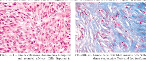 Figure 1 from Histopathologic study of cutaneous fibrosarcoma in dogs ...