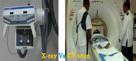 Difference Between X-ray and CT scan (with Comparison Chart) - Bio Differences