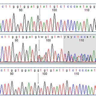 Sequence chromatograms showing (a) homozygous deletion mutation... | Download Scientific Diagram