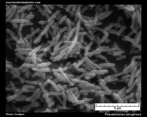 Scanning electron micrograph (SEM) of bacterial biofilm formed by ...