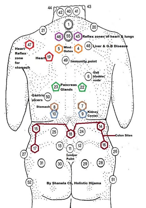 Cupping Map