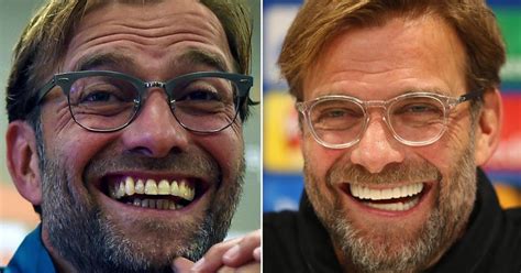 Has Jurgen Klopp Had His Teeth Done Liverpool Boss Flashes It Looks ...