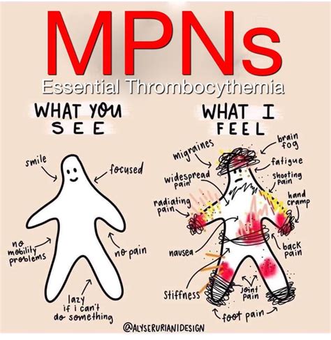 Pin by Heather Khammanivong on Everything ET disease | Essential thrombocythemia, Polycythemia ...