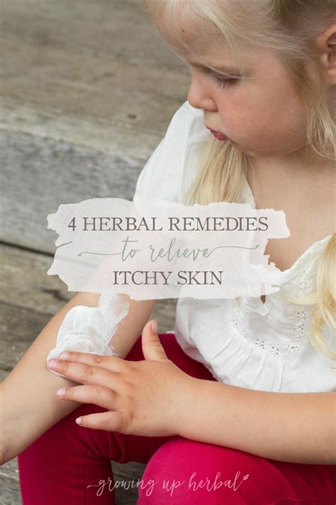 4 Herbal Remedies To Relieve Itchy Skin - GrowingUpHerbal