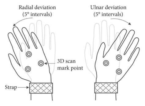 (a) Ulnar deviation and radial deviation of the wrist and (b)... | Download Scientific Diagram