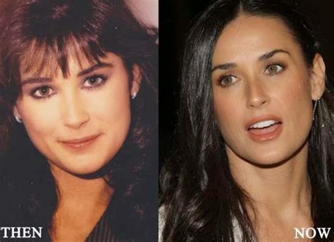 Demi Moore Plastic Surgery