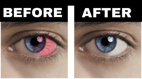 5 Ways To Protect Your Eyes From Gadgets – STJS Gadgets Portal