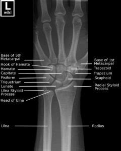 CE4RT - Radiographic Positioning of the Wrist for X-ray Technologists