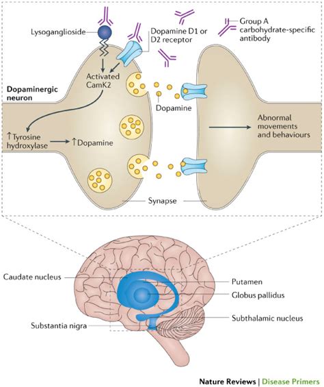 Pathogenesis of Acute Rheumatic Fever | Musculoskeletal Key