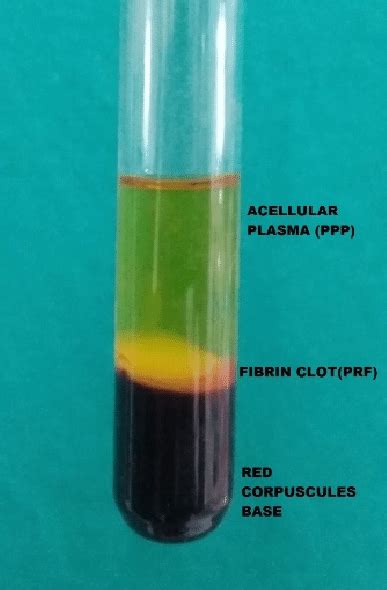 Blood centrifugation immediately after collection allows the... | Download Scientific Diagram