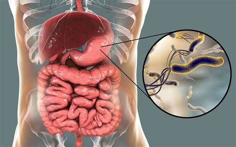 Estudio sugiere que existe sobre prescripción de la claritromicina para combatir la Helicobacter ...