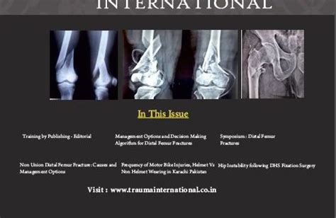 Distal Femur Fractures Archives - Trauma International