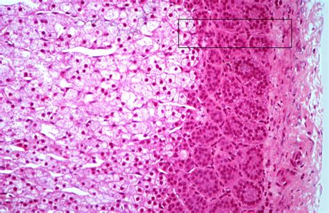 HLS [ Endocrine System, adrenal gland, cortex; zona fasciculata and glomerulosa] MED MAG