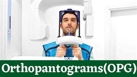 Orthopantomogram OPG X-Ray Machine: Dental X-Rays: Purpose & Procedure! What Are OPG Used For ...