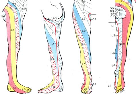 What is S1 Radiculopathy? ⋆ Santa Barbara Deep Tissue - Riktr PRO ...