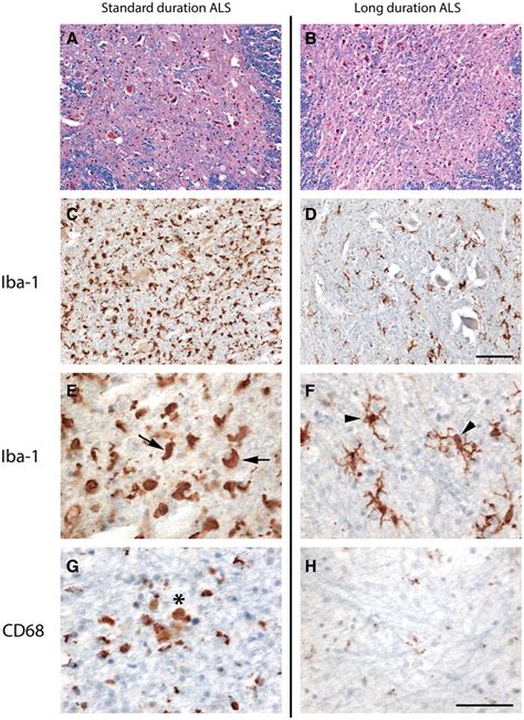 Decreased microglial cell density and resting‐type morphology within... | Download Scientific ...