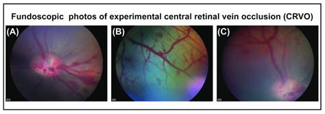 (A) Flame-shaped hemorrhages appearing in the retina within 30 min... | Download Scientific Diagram