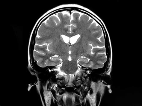 Neuroradiologist | Brain MRI Second Opinion + More | DocPanel