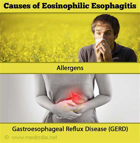 Eosinophilia Symptoms