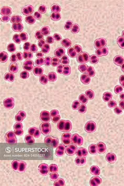 Meningococci (Neisseria Meningitidis), the bacteria in meningitis. Seen under optical microscopy ...