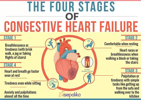 Congestive Heart Failure (CHF): Symptoms, Stages, Life Expectancy