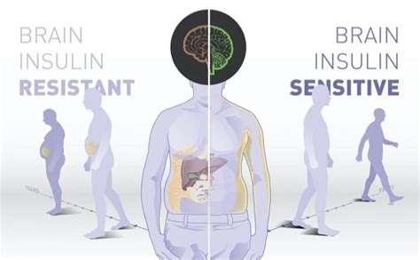 Brain insulin sensitivity determines body weight and fat distribution ...