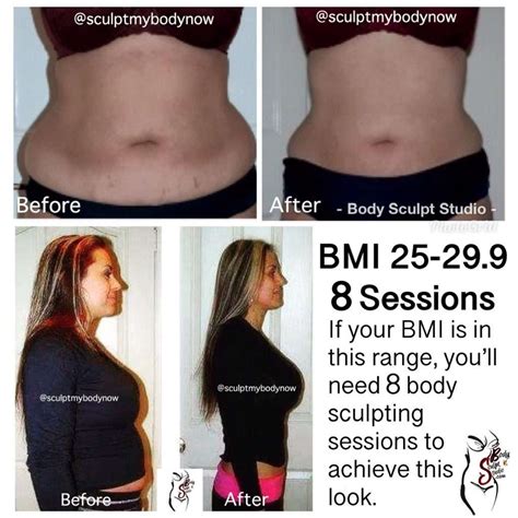 Top 99+ Pictures Bbl Surgery Before And After Pictures Sharp