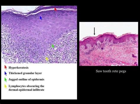 Mucocutaneous | PPT