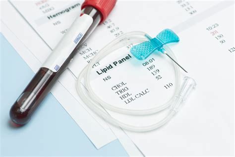 McClure's Choice - Nonfasting Lipid Testing - MCC Internal Medicine