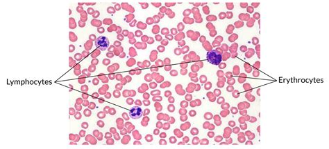 5.2 Connective Tissue Supports and Protects – Introduction to Human Biology