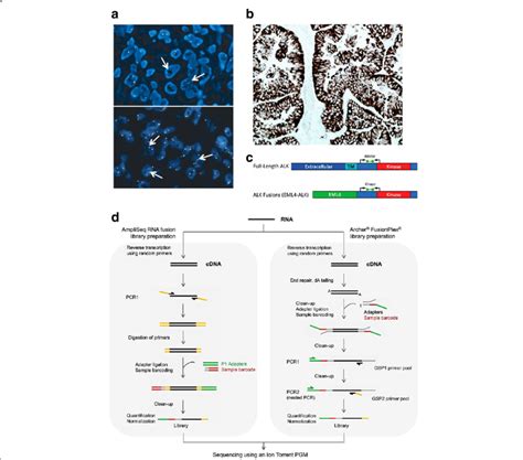 Diagnostic methods for the detection of ALK rearrangement and... | Download Scientific Diagram