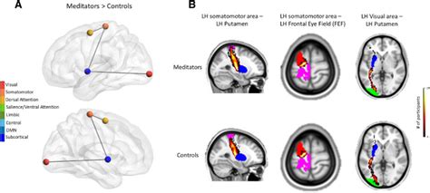 Meditation Changes the Structures and Connectivity in the Brain | Contemplative Studies