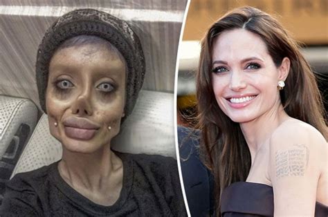 Teenager has EXTREME plastic surgery to look like Angelina Jolie ...